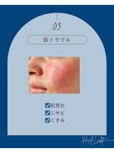 ハリヒト アランカール 仙台(HALicht Alankar)/[お悩み]肌トラブル