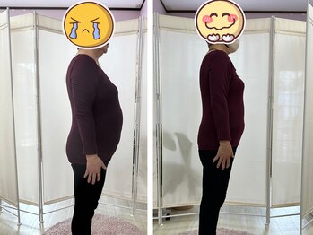 ナチュラル 裕利(natural 裕利)の写真/【本気で痩せたいアナタへ】食事制限挫折した方には[耳つぼ＋食事指導＋ダイエットカウンセリング］高茶屋