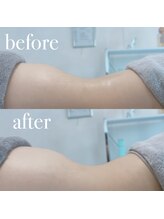 ルルアス(LUluas)/