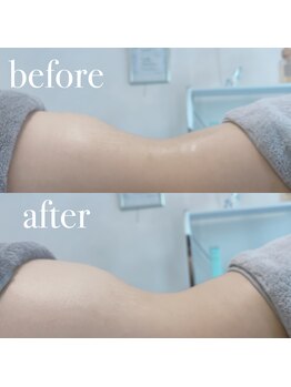 ルルアス(LUluas)/