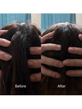 ハートランド(HEARTLAND)/小顔・むくみ改善 1回の施術