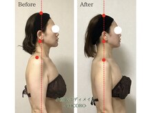 ココロ(COCORO)/立体小顔コルギ5回