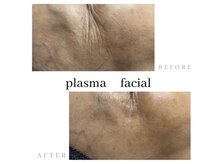 悩みに特化したメニューが豊富！まずは無料カウンセリングから