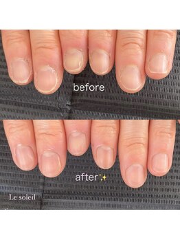 ル ソレイユ(Le soleil)/本気でネイルケア!50分