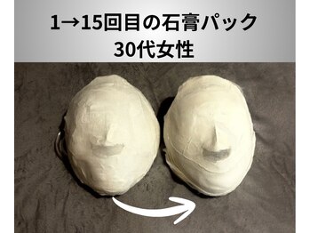 ミピマム 横浜駅前店/15回目の石膏パック/女性