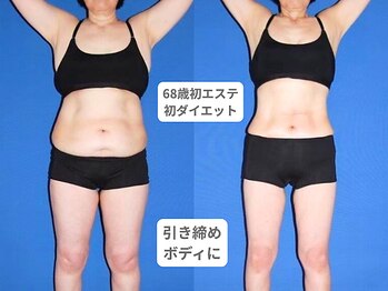 アンシャンテ 芦屋店/医師監修痩身