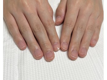 トミーズネイル(TOMMY'S NAIL)の写真/乾燥知らずの指先に！ささくれ・二枚爪に幅広く対応し、健やかな美爪を育む♪