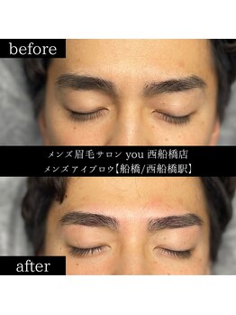 ユー 西船橋店(you)/ビフォーアフター写真