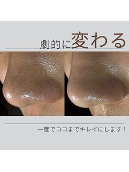 リエット(Lieto)/