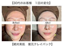 アンナチュラル 錦糸町店(ennatural)/１回で分かる絶対美白