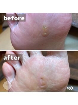 ココン フワット(cocon fouato)/タコ、魚の目ケア　銀座/有楽町