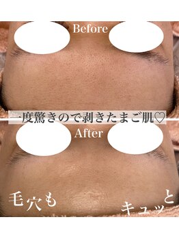 ドゥクス 難波店(Dux)/ツヤ肌×毛穴引き締め