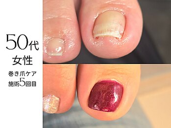 フットケア クラッシー(footcare classy)/チップケアからジェルケア♪