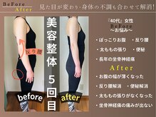 カケル(KAKERU)/施術とセルフケア指導でこの変化