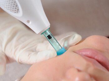 Re:cellの写真/釧路で本格毛穴ケア★黒ずみやざらつき・開き毛穴に徹底アプロ-チ!毛穴悩みを根本からケアして理想の素肌へ