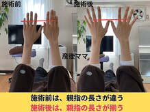アオ整体院/産後ママ　骨盤矯正☆