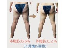 ネオボディ(Neo Body)の雰囲気（脚を細くしたい方にも効果的！Ｌ→Mサイズへダウン◎）