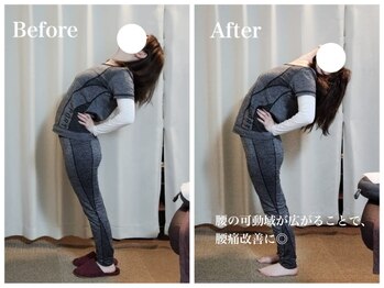 エイル(EIR)/50代女性 股関節の柔軟、腰痛