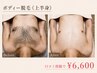 【男性口コミ限定】 ボディ脱毛 《両面上半身》￥6,600