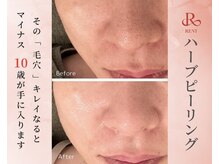 ククル(KUKULU)の雰囲気（いちご鼻もつるんと毛穴レスに◎艶も出て見た目年齢－10歳♪）