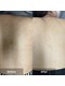 モカ 天王寺店(MOKA)の写真/【ニキビケア/毛穴】肌質改善に特化したハーブピーリング専門サロン★天王寺駅すぐの好立地で通いやすい♪