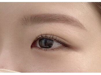 ビニッキ(BINIKKI)/