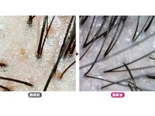 ワヤンプリ 麻布十番店/頭皮スコープ診断[港区/麻布]