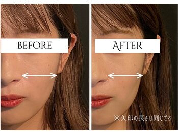 クク 赤坂 天神(99 KUKU)/【トーンアップ】