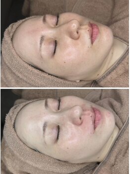 ラ ヴィスタ 川崎店(La Vista)/ララピール