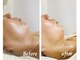 サロン ルーチェブルー(salon luceblue)の写真