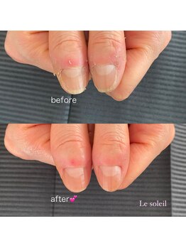 ル ソレイユ(Le soleil)/本気でネイルケア!50分