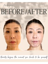 エイエービジュー(Aa.bijou)/