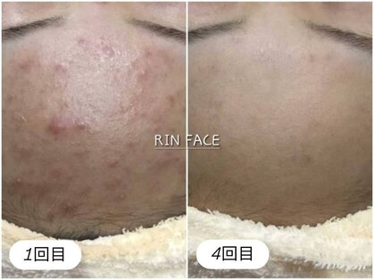 リンフェイス 銀座店(RIN FACE)の写真