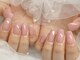 ティンク センター南 アイラッシュアンドネイル (Tink eyelash＆nail)の写真/巻き爪/深爪/チビ爪/反り爪/貝爪など爪の形にコンプレックスがある方、ネイルの持ちが悪い方に◎