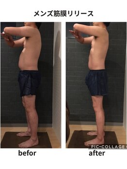 クリア(Clear)/メンズ筋膜リリース