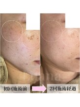 ルアナ(Luana)/【最新光フォト】