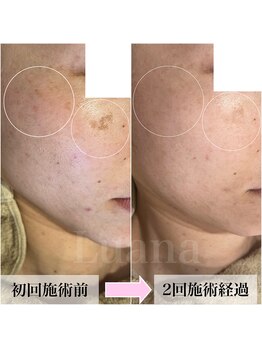 ルアナ(Luana)/【最新光フォト】