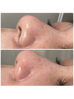 コルリース(COL Riys)/