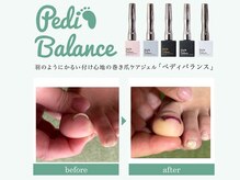 ミイア 春日部店(MiiA)/巻き爪改善ジェル　初回¥8,800