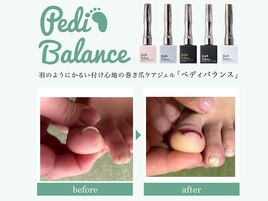 巻き爪改善ジェル　初回¥8,800