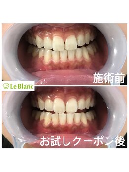 ルブラン 奈良店(Le Blanc)/旦那様のご紹介で