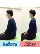 ほずみ整体院/30代男性　首こり、猫背