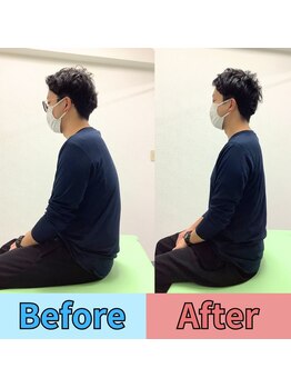 ほずみ整体院/30代男性　首こり、猫背