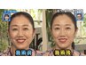 【美容鍼って痛みないの？？まずはカウンセリングだけ希望されるお客様こちら