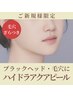 【毛穴・ブラックヘッド改善】ハイドラアクアピール＋CO2パック 90分8800円