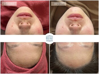 ビガク(BIGAKU)/揺らぎ肌にもおすすめ