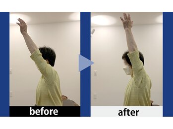 浜松整体 理学ゼーション 富塚店/ビフォーアフター