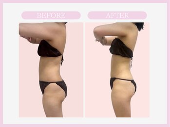 スリムライン 青森店(The Slim Line)/before→after