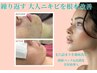 【毛穴洗浄＋鎮静】繰り返すニキビ・赤みを根本ケア90分 ¥11000 → ¥6900