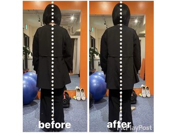 カワル整体 上通り院/腰痛と骨盤に関係はありません。